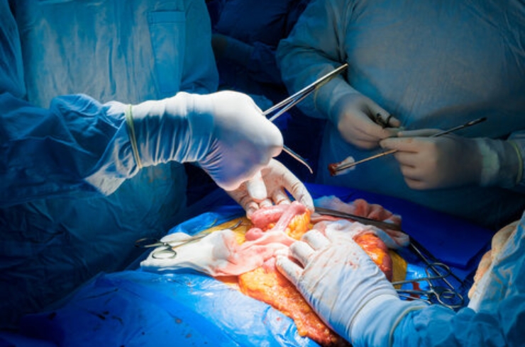 Advanced Gastrointestinal Surgery