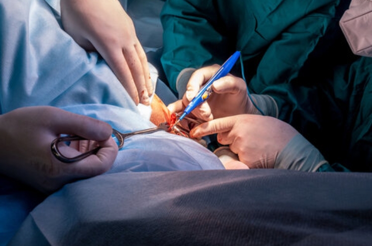 Coloproctology Procedures (Anal fissures, fistulas, piles)