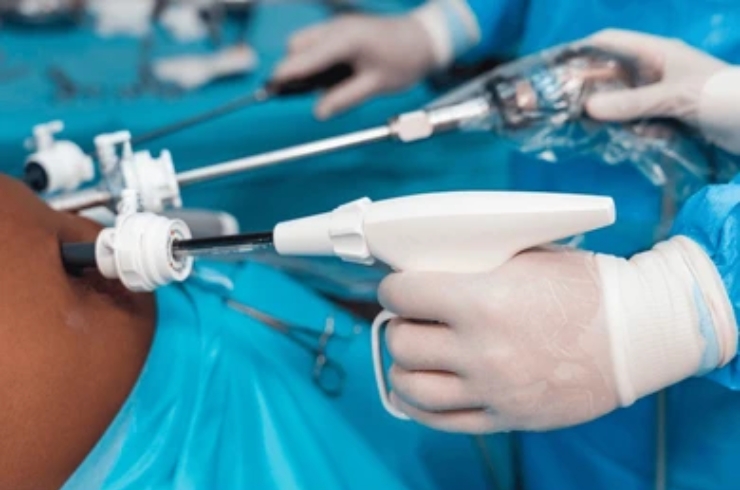 TEP (Totally Extraperitoneal Repair)