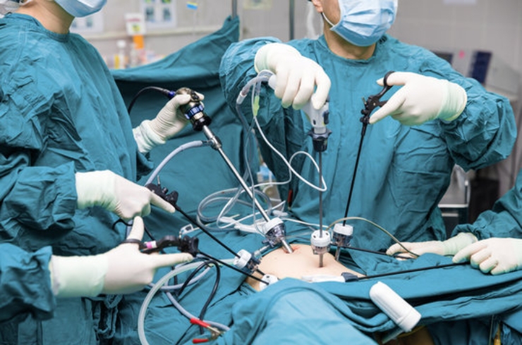 Uro-Laparoscopic Surgeries